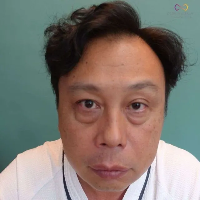 Zoe Medical patient, front-facing clinical photo