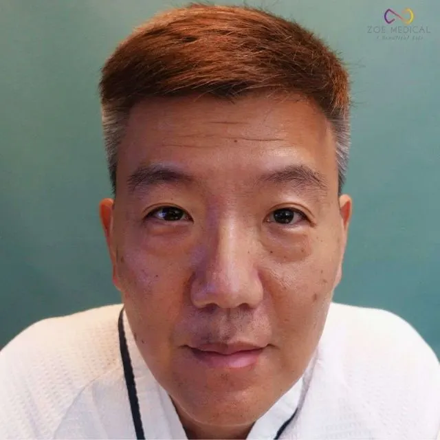 Zoe Medical patient, front-facing clinical photo