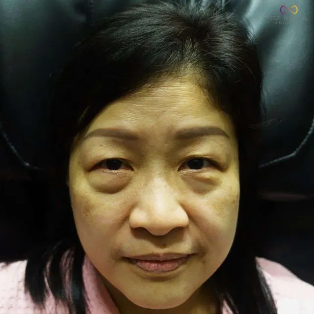 Zoe Medical patient, front-facing clinical photo