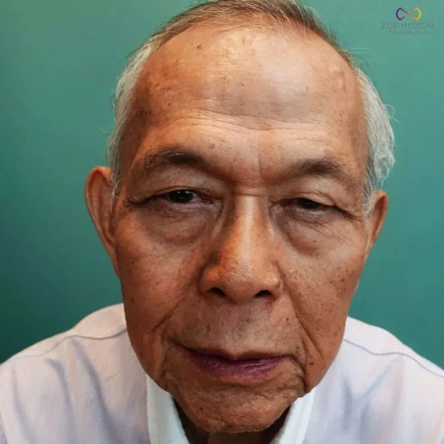 Zoe Medical patient, front-facing clinical photo