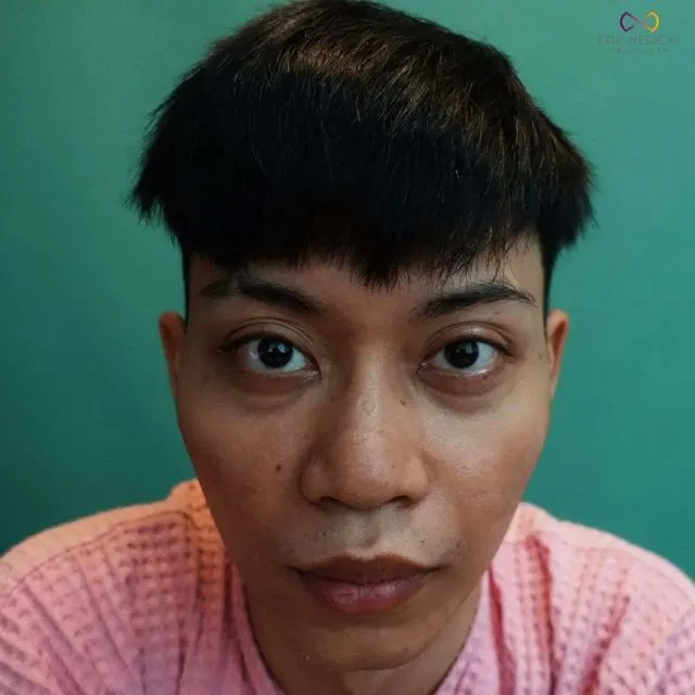 Zoe Medical patient, front-facing clinical photo